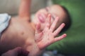 Boy with symptoms hand, foot and mouth disease Royalty Free Stock Photo