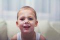 Boy with symptoms hand, foot and mouth disease Royalty Free Stock Photo