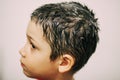 Boy treated for lice Royalty Free Stock Photo