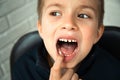 A boy of 6-7 years old shows the first teeth that grow after the loss of milk teeth Royalty Free Stock Photo
