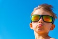 A boy in yellow sunglasses looks up, hair develops on his head. Royalty Free Stock Photo