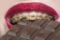 Braces and chocolate. Dental health, dentistry and stomatology. Teeth alignment. Sweet unhealthy food. Meals with braces