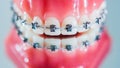 The braces are placed on the teeth in the artificial jaw. Macro photography Royalty Free Stock Photo
