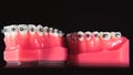 The braces are on the teeth in the artificial jaw on a black background. Macro photography Royalty Free Stock Photo