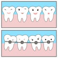 Braces teeth of icon painting line applications websites. Crowding teeth, dental concept. Comics about orthodontic treatment.