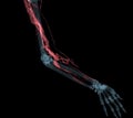 Brachial Arteries of the arm with Upper extremity Bone 3D rendering from CT Scanner