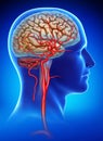 Schematic and descriptive illustration of the aneurysm in the human brain.