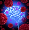 Brain Cancer Royalty Free Stock Photo