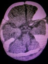 Brain computed tomography