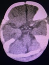 Brain computed tomography