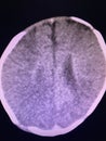 Brain computed tomography