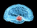 Brain degenerative diseases, Parkinson's, body, face Royalty Free Stock Photo