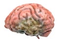 Brain disease concept. 3D rendering Royalty Free Stock Photo