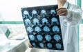 Brain disease diagnosis with medical doctor seeing Magnetic Resonance Imaging MRI film diagnosing elderly ageing patient