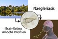 Flagellate form of the parasite Naegleria fowleri