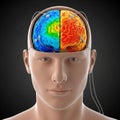 Brain exposed. The brain is colored to indicate different regions: the Royalty Free Stock Photo