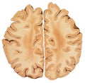 Brain - Higher Region Cross Section Royalty Free Stock Photo
