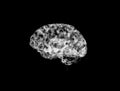 Brain impulses for Neuron system White