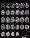 Brain MRI children 10 years