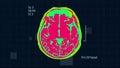 Brain MRT scan. Full HD medical background. Seamless looping