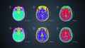 Brain MRT scan. 6 views on one screen. 4k medical colorful background