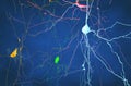 Brain, neurons, synapses, neural network circuit of neurons, degenerative diseases, Parkinson Royalty Free Stock Photo