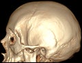 Brain sagital 3D CT