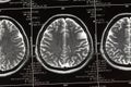 Brain scan, Neurology tomography concept Royalty Free Stock Photo