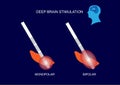 Brain stimulation mode of DBS for Parkinson`s disease