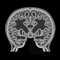 Brain Transverse Section Scan - Illustration