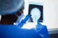 Brain xray, medical doctor and surgery charts, test results and healthcare analysis of the head. Radiology, neurology