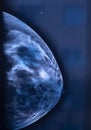 Breast mamogram xray test