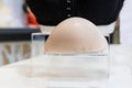 Breast prosthesis and post surgery bra for breast cancer patient after mastectomy