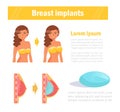 Before and after. Breast surgery. Implants Vector. Cartoon. Isolated art on white background. Royalty Free Stock Photo