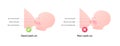 Breastfeeding infographic chart. Vector flat healthcare illustration. Diagram with text of mother and baby breast feeding. Side
