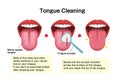 Breath, tongue, health, open, female, wellbeing, smell, hygiene, oral, scraper, clean, cleaner, dental, bad, face, wellness, care