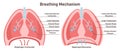 Breathing mechanism. Anatomical mechanism of the healthy human lungs