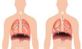 Breathing process. Respiration system Diaphragm. Inhalation and Exhalation. Breathing in and Breathing out