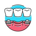 bridge dental procedure color icon vector illustration