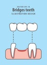 Bridges teeth illustration vector on blue background. Dental