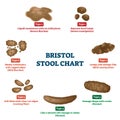 Bristol stool chart tool for faeces type classification vector illustration