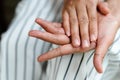 Brittle damaged nails after using shellac or gel-lacquer Royalty Free Stock Photo