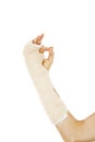 Broken arm bone in cast making OK sign Royalty Free Stock Photo