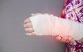 Broken arm concept. Cast broken arm for immobilize after arm and hand injury Royalty Free Stock Photo