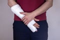 Broken arm, fingers. A white man in a red T-shirt with a cast on his arm. Royalty Free Stock Photo