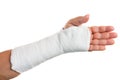 Broken arm with a plaster cast Royalty Free Stock Photo