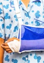 Broken arm Royalty Free Stock Photo