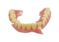 Broken denture isolate on white background Royalty Free Stock Photo
