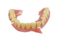 Broken denture isolate on white background