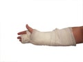 Broken hand plaster. right hand. male. isolated